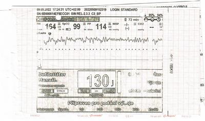 Sudden cardiac arrest in a child with Gitelman syndrome: a case report and literature review